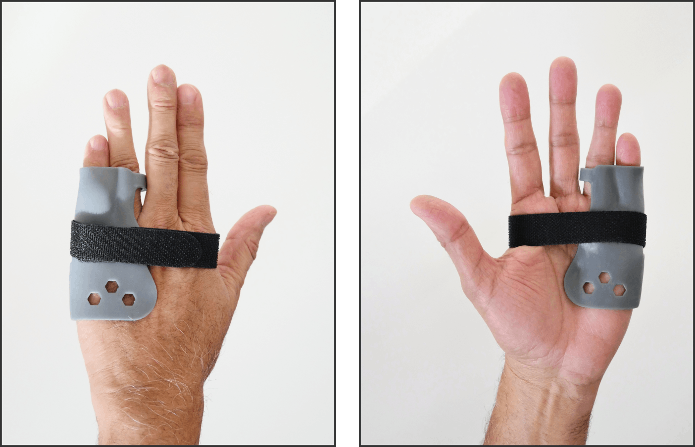 Front and back of hand showing how the prototype sits on the hand