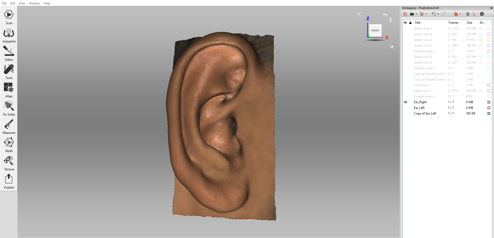 Scanned right ear shown in Artec Studio